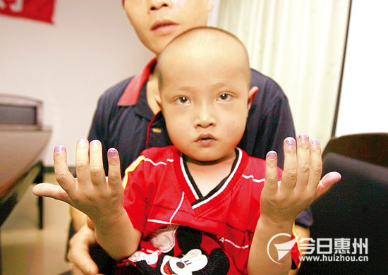 博罗4岁半男孩患有先天性心脏病 手术费愁煞家